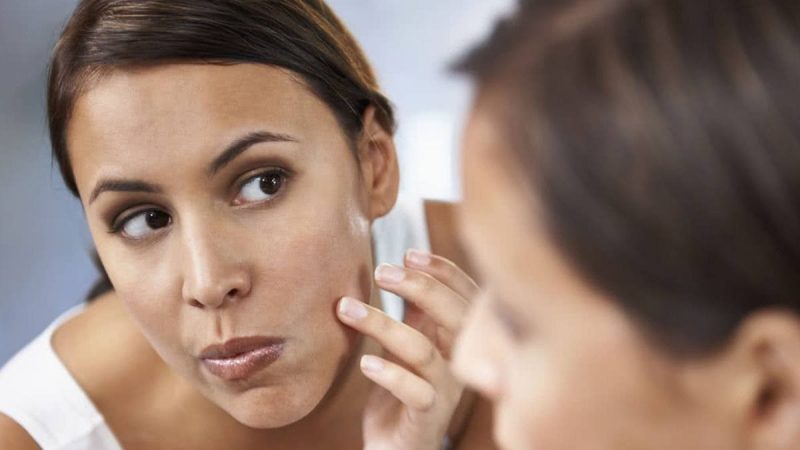 Perché la pelle del viso diventa grassa: 5 abitudini da eliminare